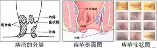 微信图片_20171202002011.png